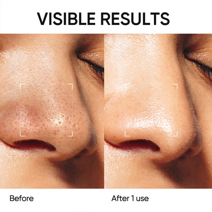 Alaska Volcano Pore Clay Stick Mask - Deep Cleansing & Blackhead Removal for Oily Skin