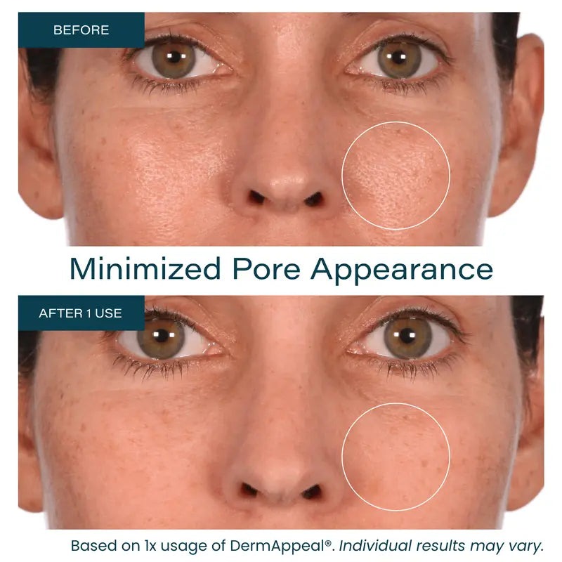 Microdermabrasion Facial Exfoliate Treatment with Advanced Crystal Technology for All Skin Types