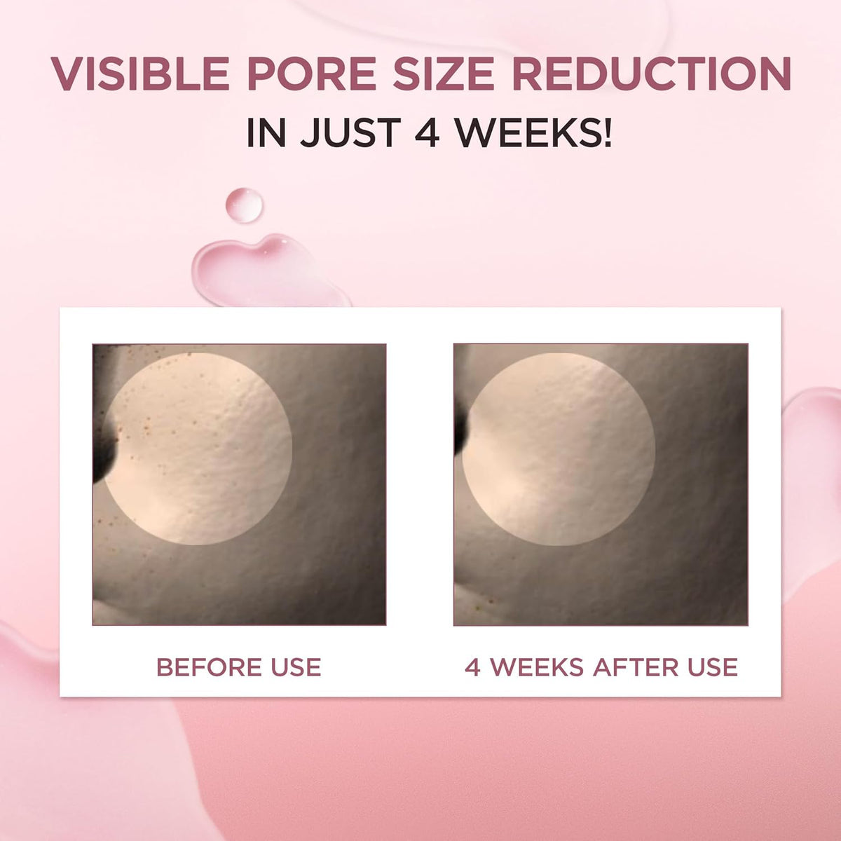 Madagascar Centella Poremizing Fresh Ampoule - Soothing Hydration for Oily & Combination Skin