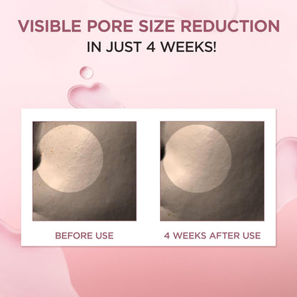 Madagascar Centella Poremizing Fresh Ampoule - Soothing Hydration for Oily & Combination Skin