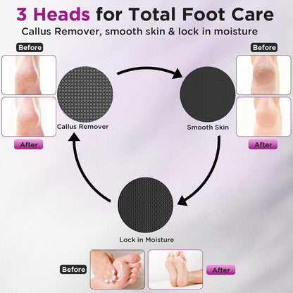Electric Foot Callus Remover with Nano-Glass Head and Lotion Applicator